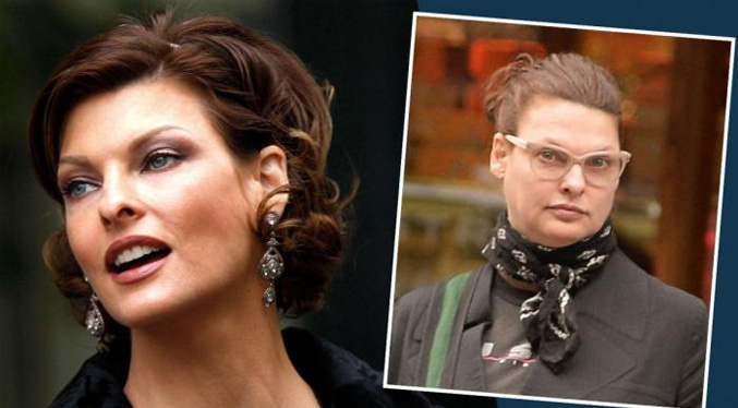 Linda Evangelista confiesa que tratamiento estético le ha “deformado permanentemente»