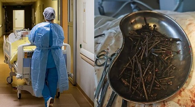 Hombre se traga un kilo de clavos y tornillos: médicos lo operaron durante tres horas