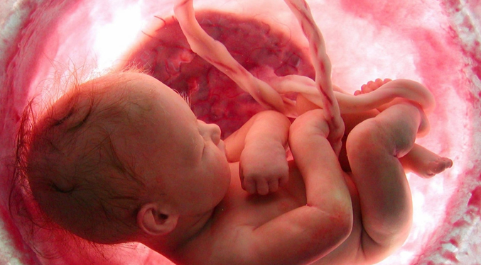Especialistas operaron en Colombia un feto en el vientre de la madre con apenas 25 semanas