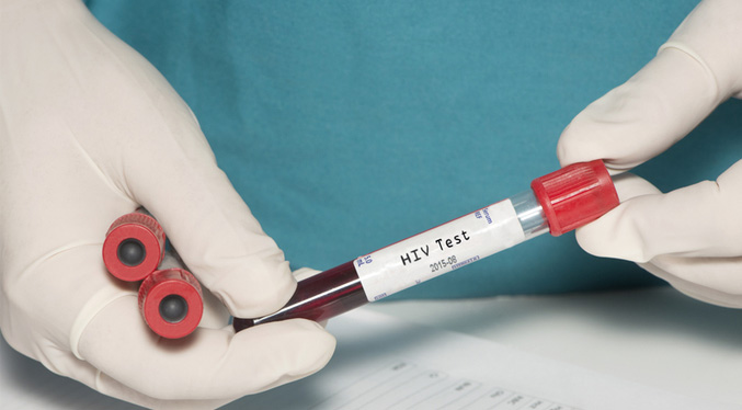 Comienzan los ensayos en humanos de una vacuna contra el VIH