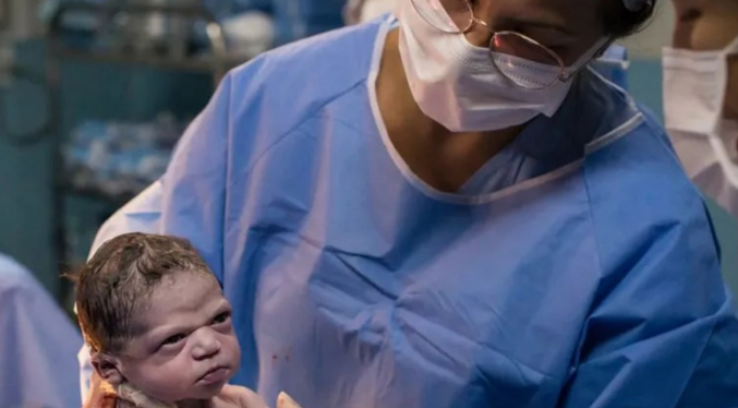 Fotógrafo tiene un reencuentro con la bebé que nació “enojada”