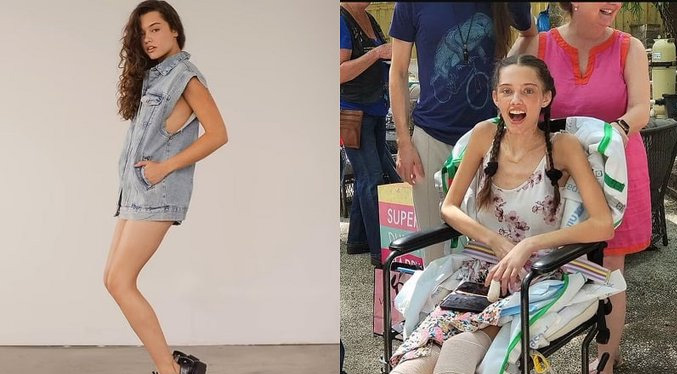 La modelo Claire Bridges pierde ambas piernas tras contagiarse de COVID-19