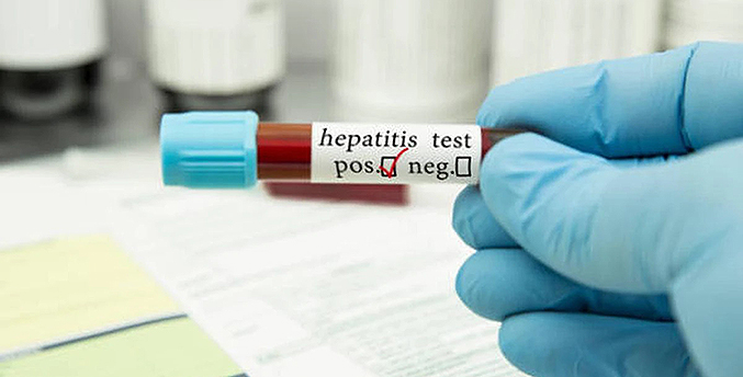Mas de un millón de personas murieron por hepatitis viral en el mundo durante 2022