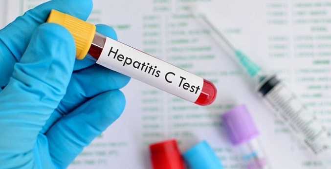 OMS registra 348 casos de misteriosa hepatitis en 20 países