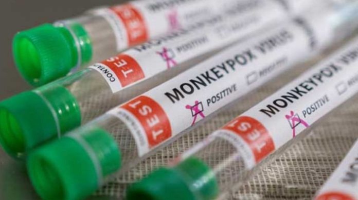 Autoridades sanitarias de Portugal notifican 348 casos de viruela del mono