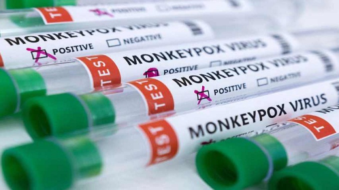 España es el país con más casos de viruela del mono