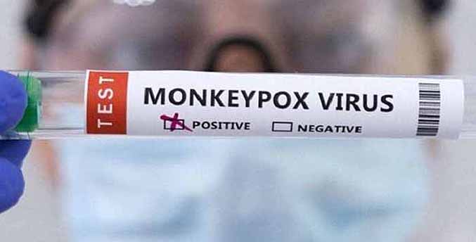 Cuba confirma su primer caso de viruela del mono