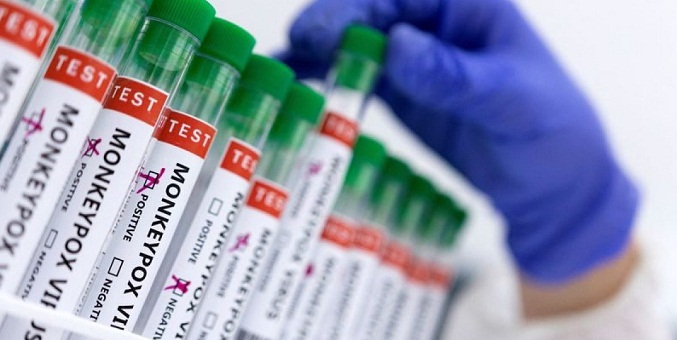 EEUU anuncia otros 1,8 millones de dosis de vacunas contra la viruela del mono
