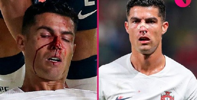 El violento golpe a Cristiano Ronaldo que asustó a todos