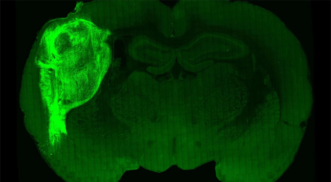 Implantan células del cerebro humano en ratas para estudiar desórdenes psiquiátricos