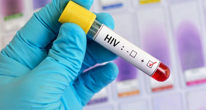 Exhortan a las autoridades a garantizar insumos para pacientes con VIH