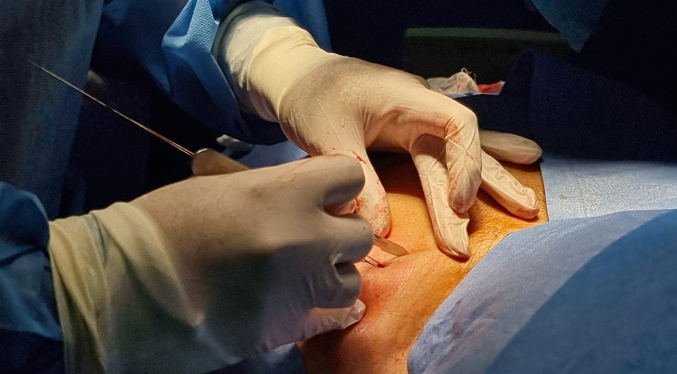Continúa implantación de marcapasos a pacientes del Hospital General del Sur