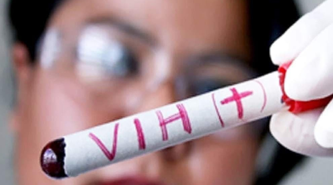 Autoridades sanitarias de Venezuela reportan deficiencias para detectar nuevos casos de tuberculosis y VIH