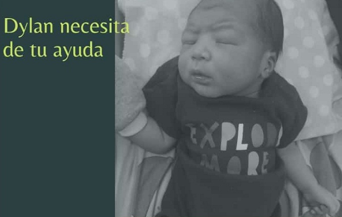 El bebé Dylan Hernández requiere de la ayuda de todos para ser operado
