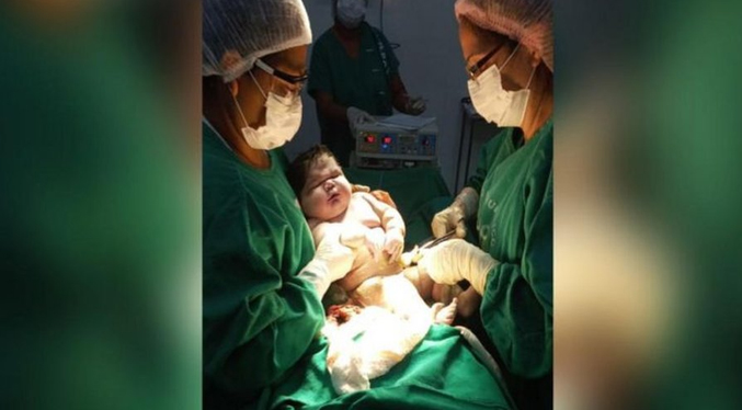 Nace un “bebé gigante” de 7,3 kg en Brasil