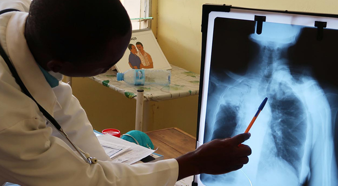 OMS insta a Europa a aumentar esfuerzos para acabar con la tuberculosis