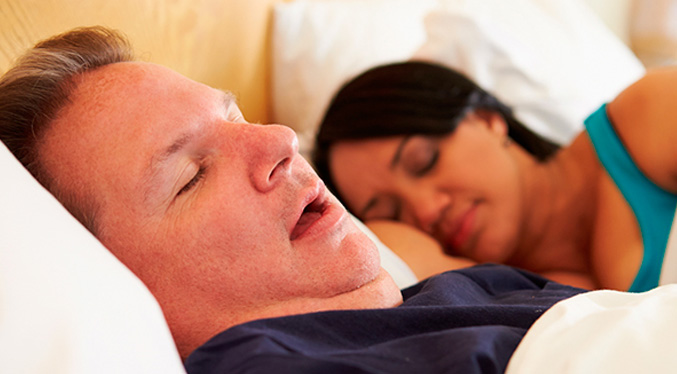 La apnea del sueño es un trastorno grave para los pacientes obesos