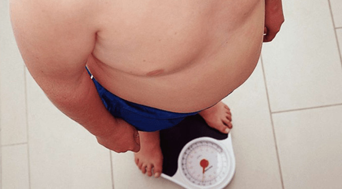 Cada vez más niños y adolescentes se someten a cirugías para bajar de peso en EEUU