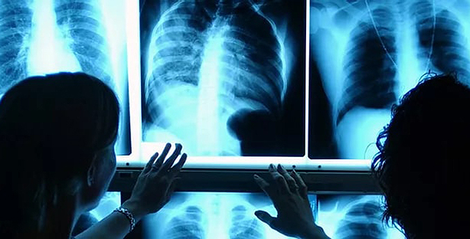 Falta de equipos y personal médico impiden avance de las especialidades radiológicas