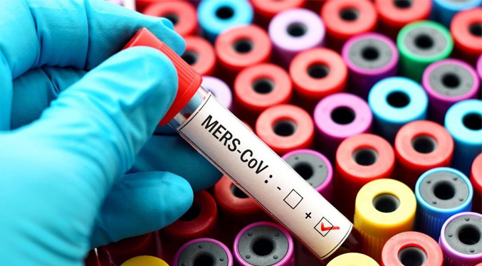 OMS alerta sobre caso de virus MERS en humanos