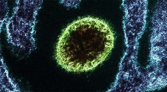 IVIC señala que Nipah es una enfermedad vírica que puede convertirse en pandemia