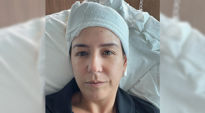 Erika De la Vega se recupera de una craneotomía por un tumor benigno
