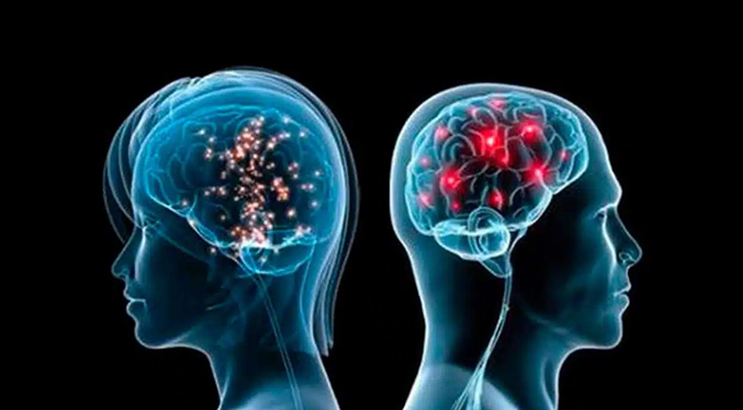 Estudio basado en IA identifica que cerebros de hombres y mujeres están organizados de forma diferente