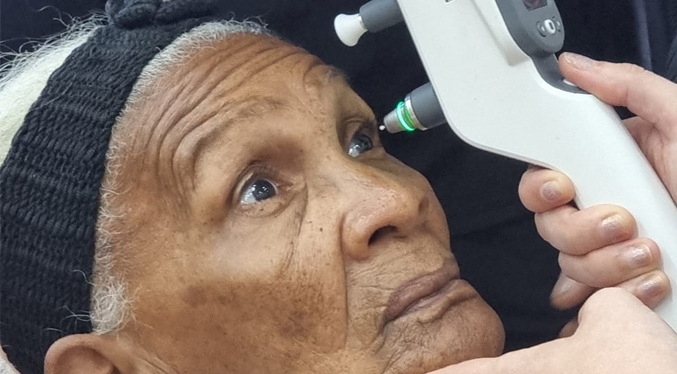 Realizan 200 evaluaciones oftalmológicas a pacientes que requieren de cirugías de cataratas en Zulia