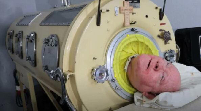 Muere el último hombre que vivía en un “pulmón de hierro”: Pasó 70 años acostado dentro de la máquina