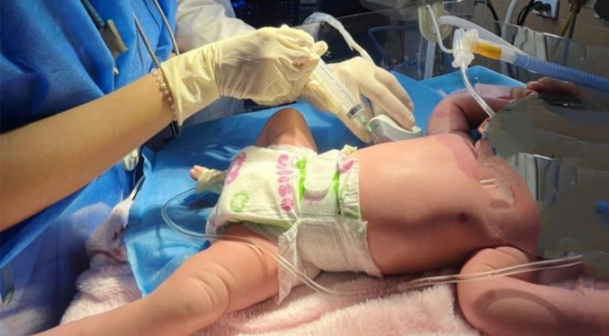 Realizan cirugía a una bebé posterior a su nacimiento en el SAHUM