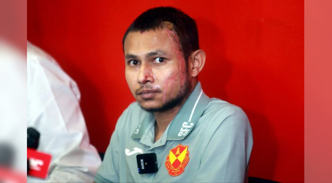 Futbolista atacado con ácido en Malasia volverá a jugar: Su duro relato