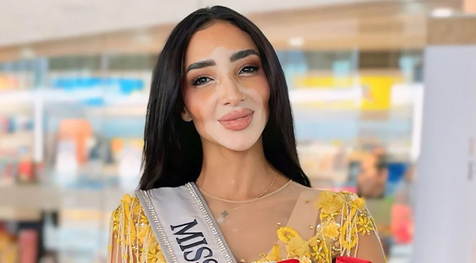 Logina Salah, la primera concursante de Miss Universo con vitíligo: ‘Me ha hecho una persona mucho más fuerte’