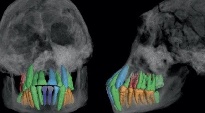 Estos dientes fósiles revelan que una infancia prolongada es clave para los cerebros complejos