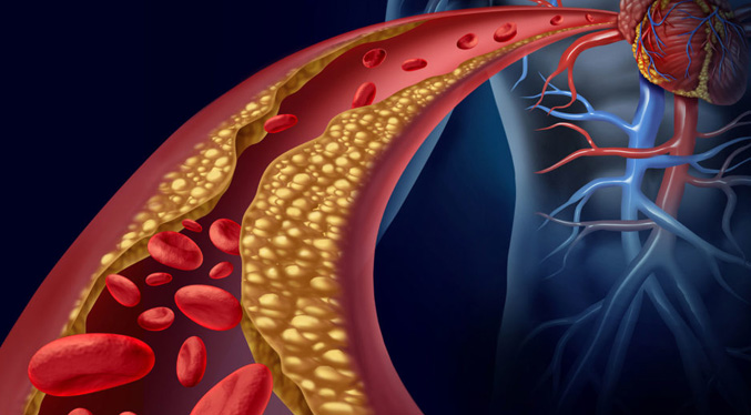 Descubren cómo actúa el colesterol ‘malo’ en el organismo