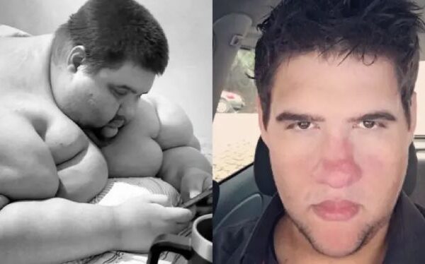 Fallece influencer que perdió 200 kilos y luchaba contra la obesidad