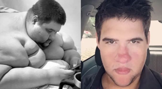 Fallece influencer que perdió 200 kilos y luchaba contra la obesidad