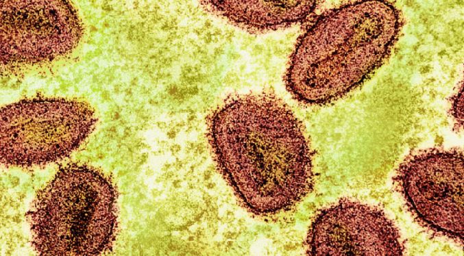 Francia detecta el primer caso del virus de mpox 1b