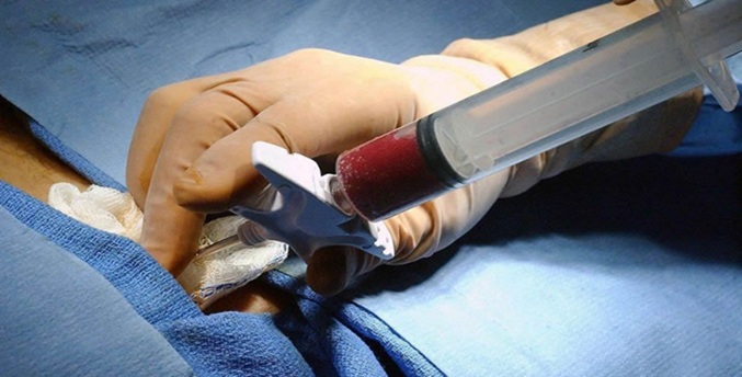 Fundamédula expone la complejidad del trasplante e insta al apoyo