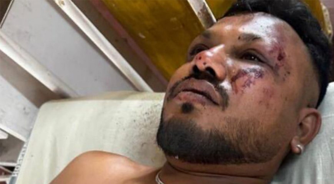 Rescatistas hallan a un superviviente del accidente aéreo de Air India