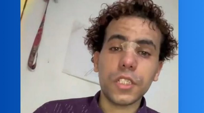 MP investigará el caso del joven agredido por su cliente en Caracas