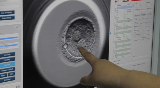 Graban por primera vez el proceso de implantación de un embrión humano en tiempo real