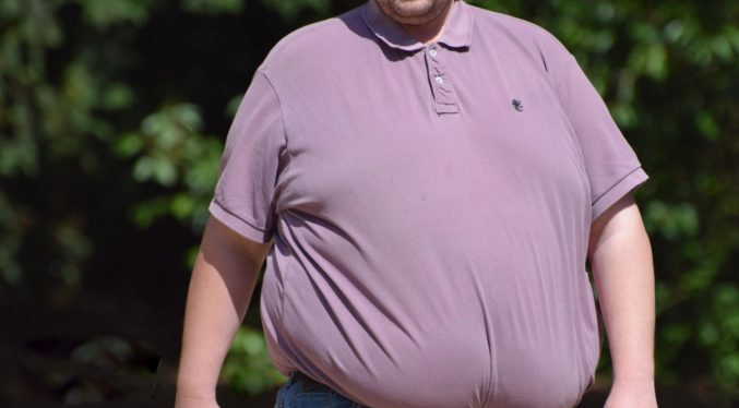 Italia se convierte en el primer país en reconocer la obesidad como enfermedad crónica