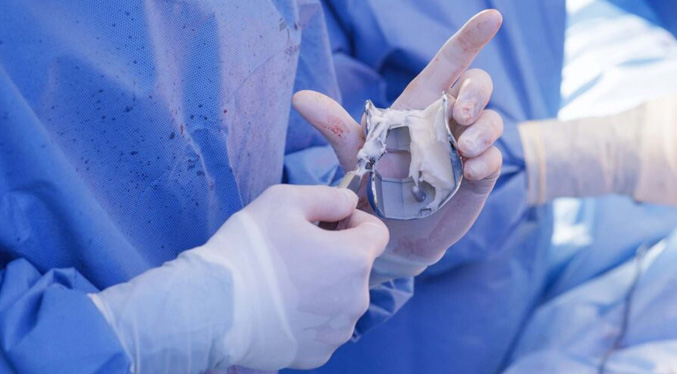 Hong Kong desarrolla nanocemento óseo para tratamiento de fracturas y reparación rápida