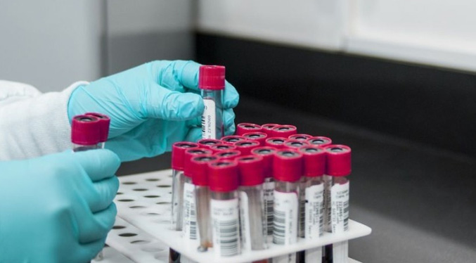 Investigadores identifican un marcador en sangre que podría ser clave en fases iniciales del alzhéimer