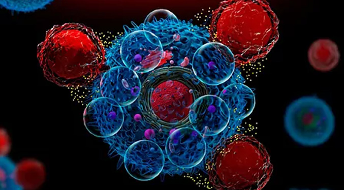 Investigadores identifican la célula que origina el Sarcoma de Ewing