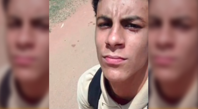 Localizan con balazo en la espalda a joven que estaba desaparecido en Puerto Ordaz