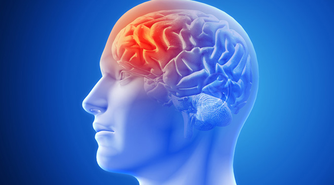 Casos de migraña se duplican y amenazan la capacidad laboral de la mujer para 2050