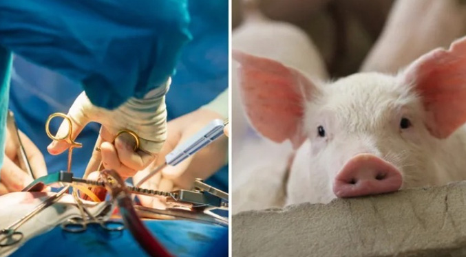Logran primer trasplante a cerdos de riñones porcinos modificados con organoides humanos