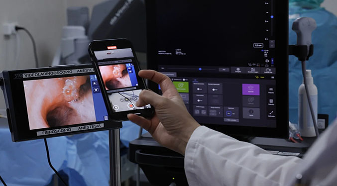 Un venezolano es operado en España de un tumor con cirugía robótica pionera en el mundo