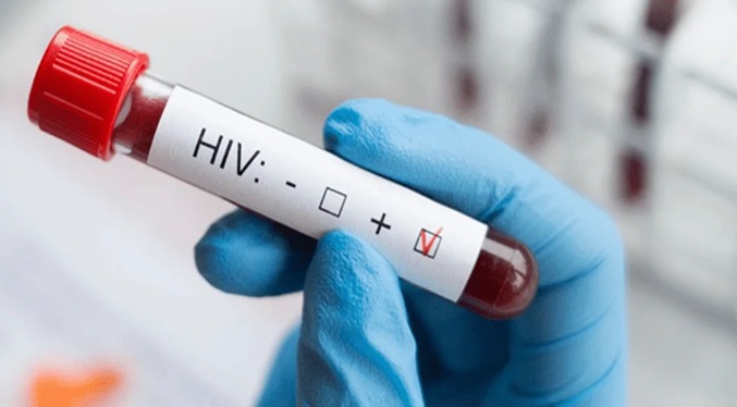 Casi 40 % de las personas con VIH en Venezuela desconoce su diagnóstico